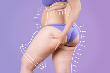 Buttocks, hip, back liposuction, fat and cellulite removal concept, overweight female body with painted surgical lines and arrows - obrazy, fototapety, plakaty