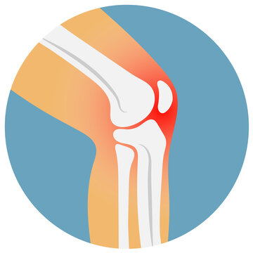 recommend clip art: knee injury icon
