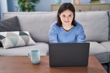 Young woman with down syndrome using laptop and drinking coffee sitting on sofa at home