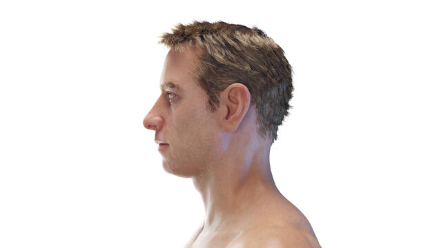 3d rendered medical illustration of a male head