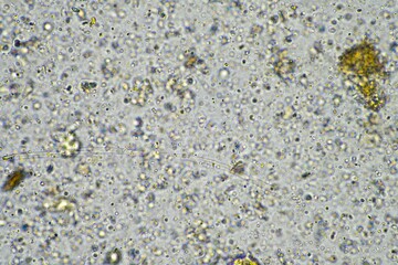 soil fungi under the microscope, soil microbes organisms in a soil and compost sample, fungus and fungi and under the microscope in regenerative agriculture. in australia.