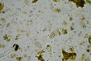 microorganisms and soil biology, with nematodes and fungi under the microscope.