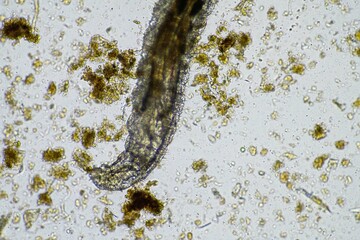 microorganisms and soil biology, with nematodes and fungi under the microscope. in a soil and compost sample
