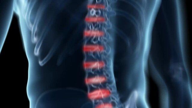 3d rendered medical animation of  a painful back
