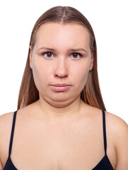 Woman with double chin and obesity.