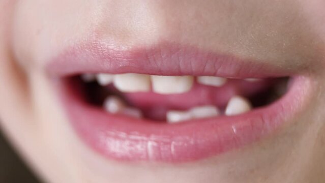The first baby baby tooth or temporary tooth loss