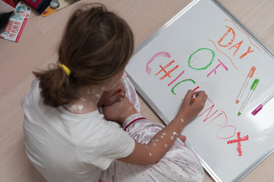 Top view of Little school girl with chickenpox drawing on white board in kids' room, antiseptic cream applied to face and body. Chalkboard and toys background. 