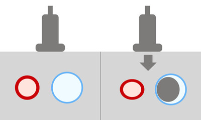 Diagram of Abnormal Non Compression Ultrasound For Diagnosis of Deep Vein Thrombosis