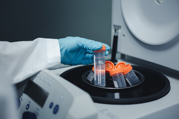 Researcher put the test tube of DNA extraction from Ecoli into a centrifuge machine to separate the...