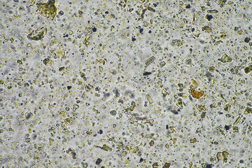 microorganisms and soil biology, with nematodes and fungi under the microscope. in a soil and compost sample
