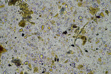 microorganisms and soil biology, with nematodes and fungi under the microscope. in a soil and compost sample