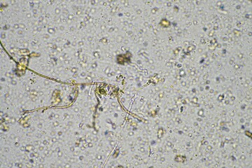 microorganisms and soil biology, with nematodes and fungi under the microscope. in a soil and compost sample