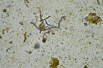 Fungi and fungus in a soil sample under the microscope 