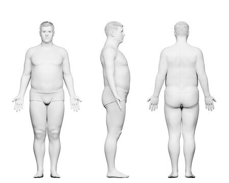 3d rendered medical illustration of a potbellied male body