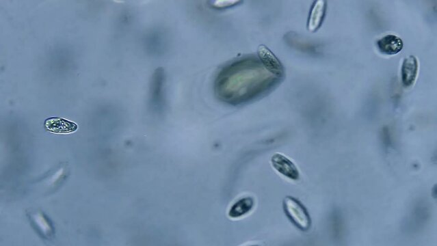 Micro organisms - paramecium, ciliates, magnification 10x