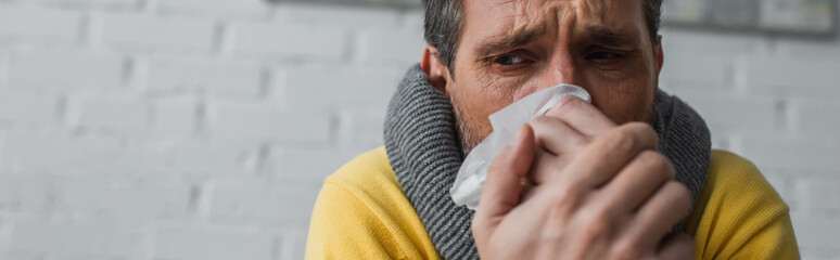 ill man in warm scarf suffering from runny nose and holding paper napkin near face, banner.