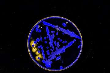 colonies of bacteria in a petri dish under ultraviolet light