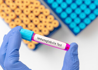 Obraz premium Immunoglobulin A or IgA level diagnosis for immunodeficiency disease test result with blood sample in test tube on doctor hand in medical lab
