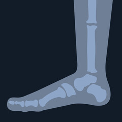 x-ray of the foot skeleton. Human leg bones. Joint anatomy