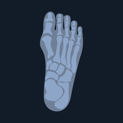 pper radiograph of a human foot or limb. X-ray or radiographic image of the bones of the metatarsus and toes, viewed from above. Medical Radiology