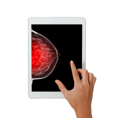 The doctor using digital tablet against X-ray Digital Mammogram  isolated on white background.