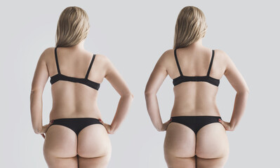 Woman's back before and after treatment. Curvature of the spine, one shoulder higher than the other...