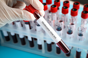 Monkeypox virus test. Laboratory worker holding sample tube with blood near rack, closeup
