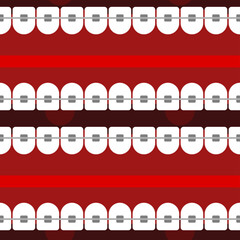 Fototapeta premium Mouth with braces Pattern seamless. correction of occlusion and crooked teeth. Vector Background