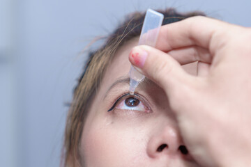 Male doctor ophthalmologists dripping eye drops on eyes of a female patient during a treatment at the ophthalmological office - obrazy, fototapety, plakaty