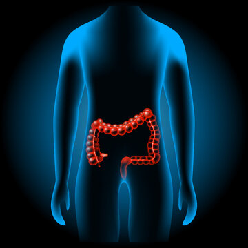Large intestine into  x-ray blue realistic torso. 