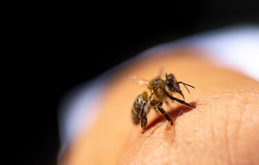 A bee on a person's hand close-up. Insect bite. A bee crawls over a person's skin.