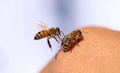 A bee on a person's hand close-up. Insect bite. A bee crawls over a person's skin.