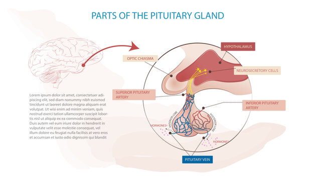 Parts of the pituitary gland, the cause of some diseases such as acromegaly.