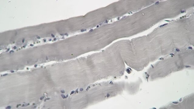 Skeletal muscle in longitudinal section under microscope filmed with 400 times magnification on bright field. Educating human anatomy and inner building with lab equipment and devices. Bicep structure