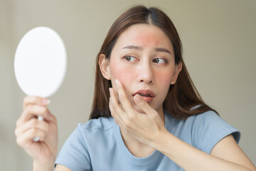Dermatology, scratch asian young woman looking at mirror, expression worry and itch, itchy allergy...