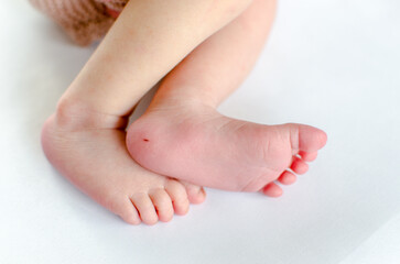 Heel prick blood test wound on a newborn foot