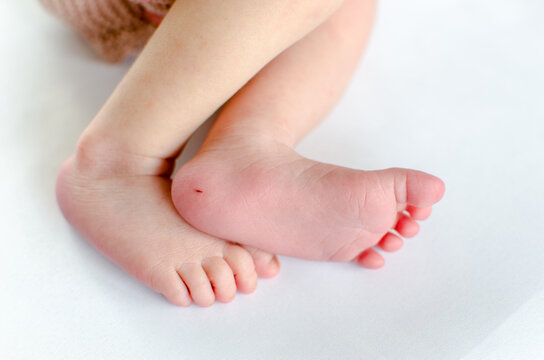 Heel prick blood test wound on a newborn foot