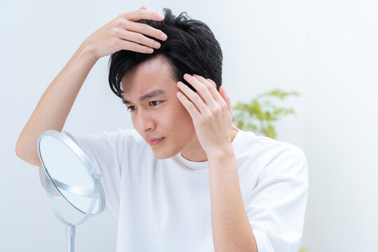 若い男性・薄毛・ハゲ