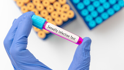 STI (sexually transmitted infection) test result with blood sample in test tube on doctor hand in...