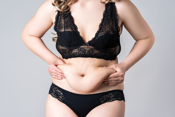 Tummy tuck, flabby skin on a fat belly, plastic surgery concept