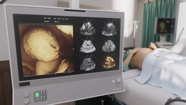 Prenatal screening a woman carrying a child at the modern clinic. Prenatal screening of the foetus inside of the female at the clinic. Prenatal ultrasound screening of the pregnant female at a clinic.