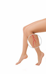 Cropped woman's legs with varicose veins close-up with magnifying glass, isolated on white background. Varicose