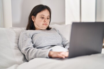 Young woman with down syndrome using laptop sitting on bed at bedroom