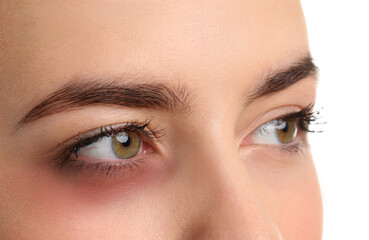 Fototapeta premium Young woman with bruise under eye, closeup