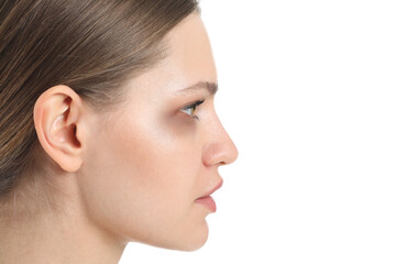 Young woman with bruise under eye on white background