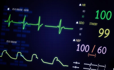 Patient monitor showing vital signs ECG and EKG.