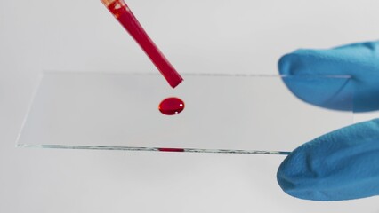 Laboratory blood test. Medical research concept