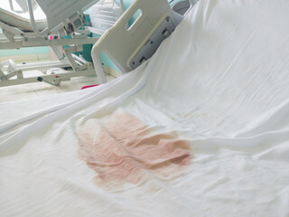 Fototapeta na wymiar bloodstains of hospital patients on white mattress, bleeding after giving birth