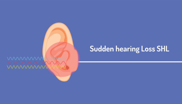 Vector illustration of an ear and sudden hearing loss SHL