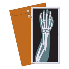 Broken arm x-ray film vector illustration in line filled design